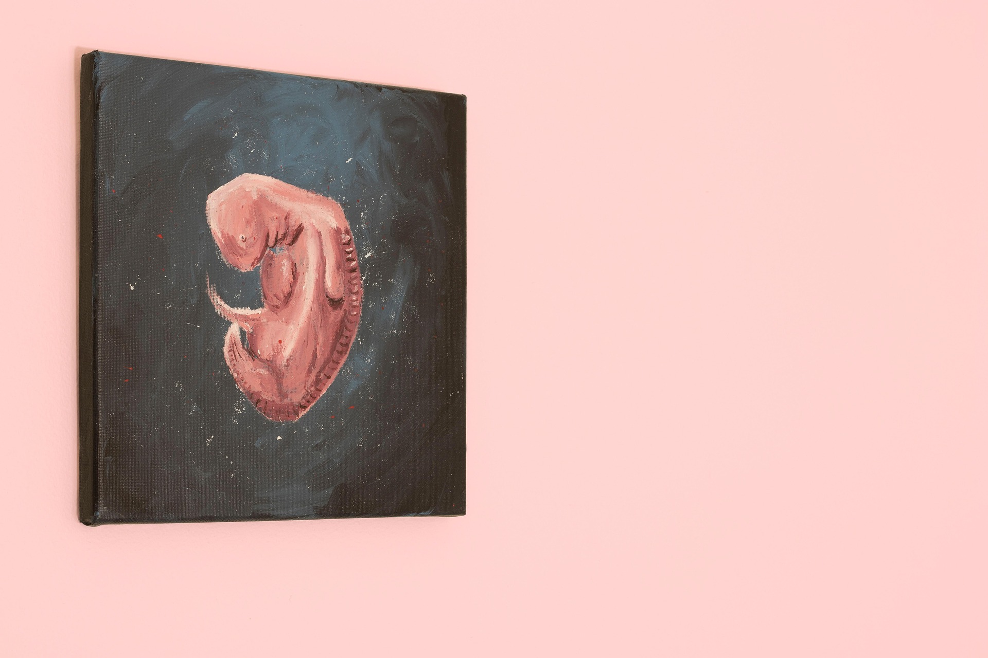 aborto